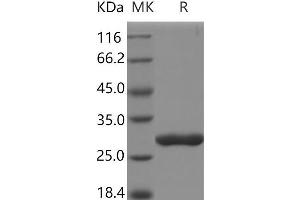 Western Blotting (WB) image for Chymotrypsinogen B1 (CTRB1) protein (His tag) (ABIN7321056) (CTRB1 Protein (His tag))