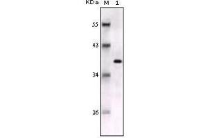 Western blot analysis using S100B mouse mAb against full-length S100B recombinant protein. (S100B antibody)