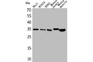Western Blot analysis of Raji BT474 K562 mouse heart mouse skeletal muscle cells using Claudin-17 Polyclonal Antibody (Claudin 17 antibody  (C-Term))