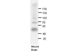 ADARB1 antibody - N-terminal region  validated by WB using Mouse brains at 1:1000. (RED1 antibody  (N-Term))