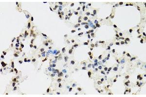Immunohistochemistry of paraffin-embedded Mouse lung using EDF1 Polyclonal Antibody at dilution of 1:100 (40x lens). (EDF1 antibody)