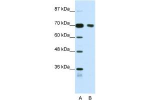 WB Suggested Anti-TRIM32 Antibody Titration:  1. (TRIM32 antibody  (N-Term))