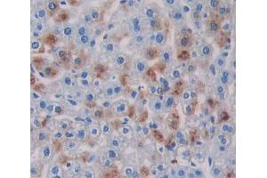 Immunohistochemistry (IHC) image for anti-ATP-Binding Cassette, Sub-Family A (ABC1), Member 5 (ABCA5) (AA 1401-1642) antibody (ABIN5013172)