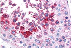 Human Testis: Formalin-Fixed, Paraffin-Embedded (FFPE) (LST1 antibody)