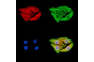 ABIN6264625 and ABIN6279750 staining Hela cells by IF/ICC.