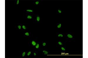 Immunofluorescence of monoclonal antibody to CCNH on HeLa cell. (Cyclin H antibody  (AA 1-110))
