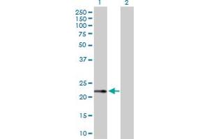 Western Blot analysis of RPS27A expression in transfected 293T cell line by RPS27A MaxPab polyclonal antibody. (RPS27A antibody  (AA 1-156))
