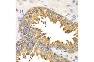 Immunohistochemistry of paraffin-embedded human prostate using DDX58 antibody (ABIN5970201) at dilution of 1/100 (40x lens).
