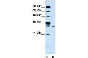 WB Suggested Anti-GLTPD2 Antibody Titration:  5. (GLTPD2 antibody  (Middle Region))