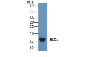 Figure. (Angiopoietin 2 antibody  (AA 352-477))