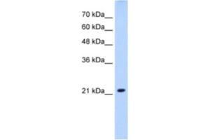 Western Blotting (WB) image for anti-Solute Carrier Family 25 (Mitochondrial Carrier, Brain), Member 14 (SLC25A14) antibody (ABIN2462743) (SLC25A14 antibody)