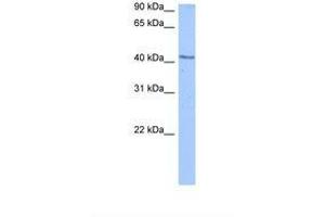 Image no. 1 for anti-DCP2 Decapping Enzyme Homolog (DCP2) (AA 265-314) antibody (ABIN6739150) (DCP2 antibody  (AA 265-314))