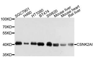 Western blot analysis of extracts of various cell lines, using CSNK2A1 antibody. (CSNK2A1/CK II alpha antibody  (AA 1-391))