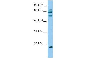 Host: Rabbit Target Name: ANKRD60 Sample Type: Fetal Liver lysates Antibody Dilution: 1. (ANKRD60 antibody  (C-Term))