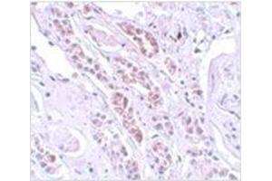 Immunohistochemistry of TCTN1 in human kidney tissue with TCTN1 antibody at 5 μg/ml. (TCTN1 antibody  (N-Term))