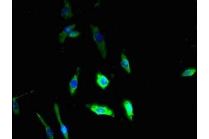 Immunofluorescent analysis of U251 cells using ABIN7149746 at dilution of 1:100 and Alexa Fluor 488-congugated AffiniPure Goat Anti-Rabbit IgG(H+L) (DSE antibody  (AA 23-270))