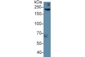 Western Blot; Sample: Human Serum; Primary Ab: 5µg/ml Rabbit Anti-Human FLNb Antibody Second Ab: 0. (FLNB antibody  (AA 1-237))