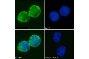 Immunofluorescence staining of Jurkat cells using anti-IL2R antibody AHT107. (Recombinant CD25 antibody)
