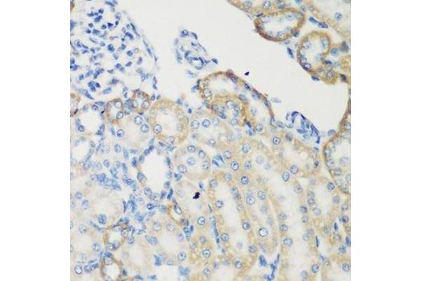 Transglutaminase 5 antibody  (AA 461-720)