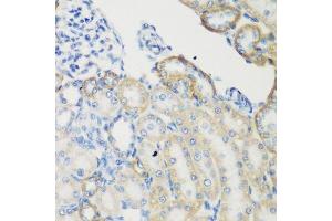 Immunohistochemistry of paraffin-embedded rat kidney using TGM5 antibody.