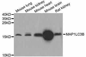 Western blot analysis of extracts of various cell lines, using MAP1LC3B antibody. (LC3B antibody  (AA 1-100))
