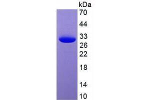 Image no. 2 for Green Fluorescent Protein (GFP) (AA 1-238) protein (His tag) (ABIN1878897) (GFP Protein (AA 1-238) (His tag))