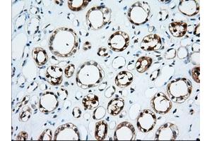 Immunohistochemical staining of paraffin-embedded Human thyroid tissue using anti-TTC32 mouse monoclonal antibody. (TTC32 antibody)