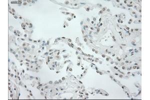 Immunohistochemical staining of paraffin-embedded prostate tissue using anti-NEUROG1mouse monoclonal antibody. (Neurogenin 1 antibody)