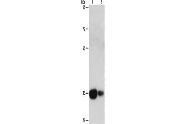 UCHL5 antibody