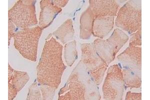 Detection of SIGIRR in Rat Skeletal muscle Tissue using Polyclonal Antibody to Single Ig IL1 Related Receptor (SIGIRR) (SIGIRR antibody  (AA 1-118))