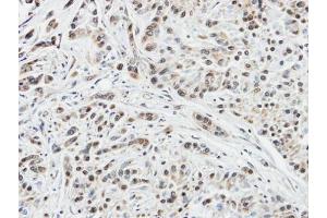 IHC-P Image Immunohistochemical analysis of paraffin-embedded A549 xenograft, using DUSP10, antibody at 1:100 dilution. (DUSP10 antibody  (C-Term))