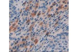 Figure. (FBLN4 antibody  (AA 136-225))