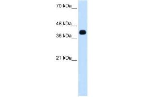 Transfected 293T; WB Suggested Anti-ZSCAN16 Antibody Titration: 0. (ZSCAN16 antibody  (N-Term))