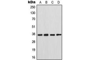 Western blot analysis of Connexin 37 expression in HeLa (A), SW620 (B), A431 (C), NIH3T3 (D) whole cell lysates. (GJA4 antibody  (Center))