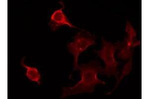 ABIN6275925 staining Hela by IF/ICC. (CLPTM1 antibody  (Internal Region))