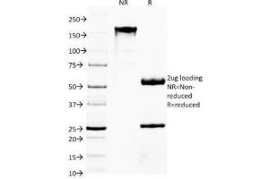 SDS-PAGE Analysis of Purified, BSA-Free FOXA1 Antibody (clone FOXA1/1514). (FOXA1 antibody  (AA 372-472))