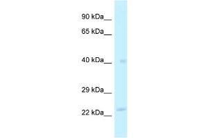 WB Suggested Anti-MRPL40 Antibody Titration: 1. (MRPL40 antibody  (Middle Region))