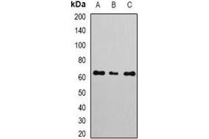 Western blot analysis of NERF expression in A549 (A), MCF7 (B), Jurkat (C) whole cell lysates. (ELF2 antibody)