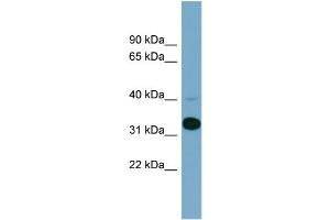 WB Suggested Anti-METAP1  Antibody Titration: 0.