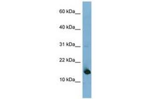 Image no. 1 for anti-Mediator Complex Subunit 31 (MED31) (N-Term) antibody (ABIN6741944) (MED31 antibody  (N-Term))