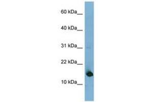 Image no. 1 for anti-Mediator Complex Subunit 31 (MED31) (N-Term) antibody (ABIN6741944)