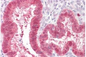 Anti-TGFB3 antibody IHC staining of human uterus.