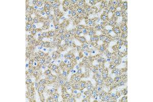 Immunohistochemistry of paraffin-embedded rat liver using MTTP antibody (ABIN5970876) at dilution of 1/100 (40x lens).