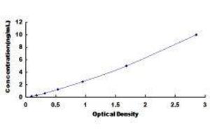 ELISA image for Cathepsin B (CTSB) ELISA Kit (ABIN433303)