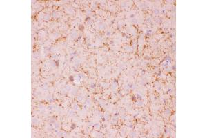 Immunohistochemistry (IHC) image for anti-Sirtuin 2 (SIRT2) (AA 165-187), (Middle Region) antibody (ABIN3043924)