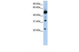 Image no. 1 for anti-Transmembrane Protein 38B (TMEM38B) (C-Term) antibody (ABIN6738352) (TMEM38B antibody  (C-Term))