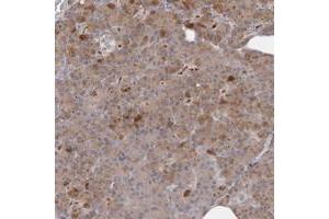 Immunohistochemical staining of human pancreas with ANKRD44 polyclonal antibody  shows moderate cytoplasmic positivity in exocrine cells. (ANKRD44 antibody)