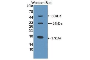 Western Blotting (WB) image for anti-Collagen, Type X (COL10) antibody (Biotin) (ABIN1175583) (COL10 antibody  (Biotin))