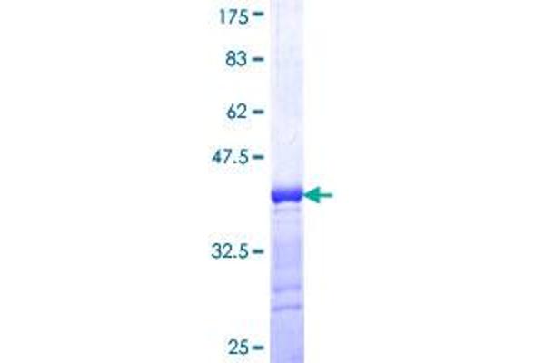 PRKG1 Protein (AA 73-170) (GST tag)