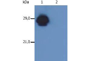 Western Blotting analysis of MHC Class II in whole cell lysate of RAJI human Burkitt lymphoma cell line using anti-human HLA-DR+DP (MEM-136). (HLA-DP/DR antibody)